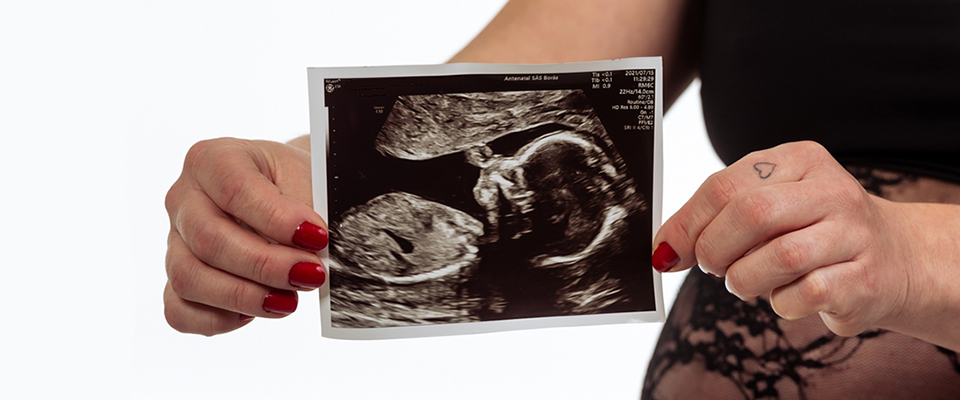 Gravidfotografering med ultraljudsbild